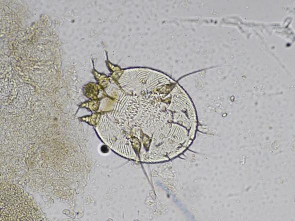 Culprit: The microscopic mite that causes untold misery to millions PICTURE: SHUTTERSTOCK
